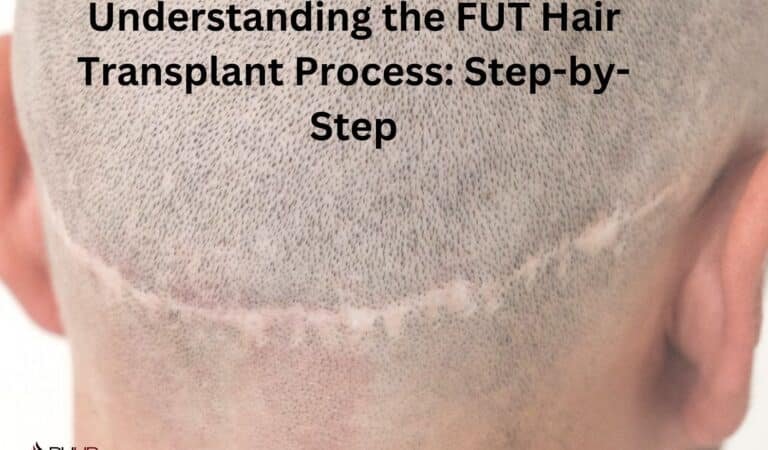 Understanding the FUT Hair Transplant Process: Step-by-Step