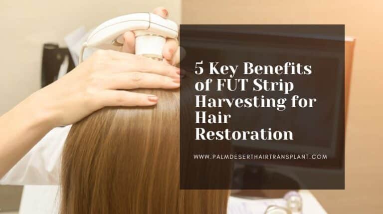 5 Key Benefits of FUT Strip Harvesting for Hair Restoration