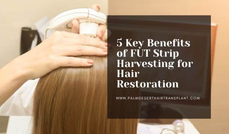 5 Key Benefits of FUT Strip Harvesting for Hair Restoration